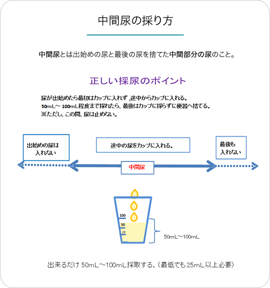 イラスト:中間尿の採り方