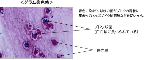 グラム染色像