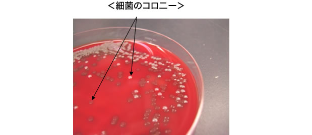 細菌のコロニー